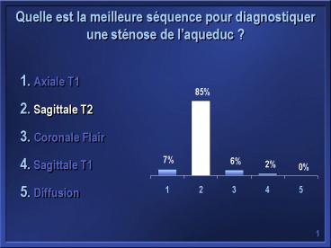 Quelle est la meilleure s