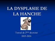 LA DYSPLASIE DE LA HANCHE
