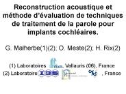 Reconstruction acoustique et m