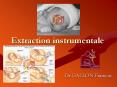 Extraction instrumentale PowerPoint PPT Presentation