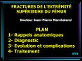 FRACTURES DE LEXTRMIT SUPRIEURE DU FMUR PowerPoint PPT Presentation