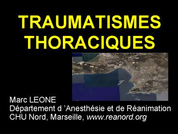 TRAUMATISMES THORACIQUES