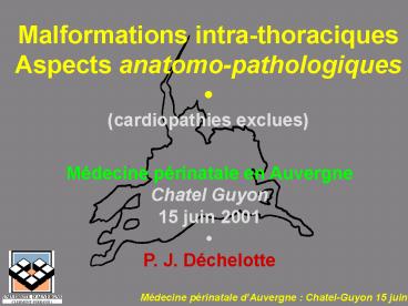 Aucun titre de diapositive
