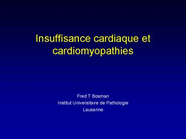 Insuffisance cardiaque et cardiomyopathies