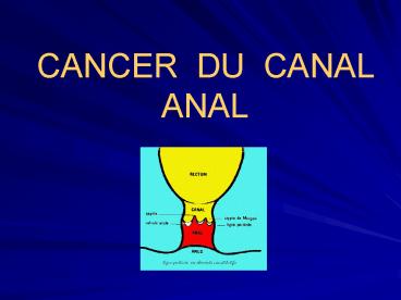 K' CANAL ANAL