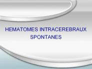 HEMATOMES%20INTRACEREBRAUX%20SPONTANES