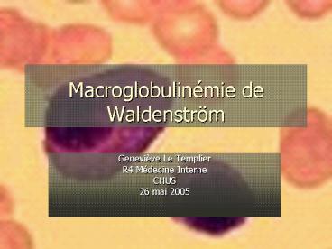 Macroglobulinmie de Waldenstrm