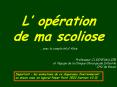 L opration de ma scoliose PowerPoint PPT Presentation