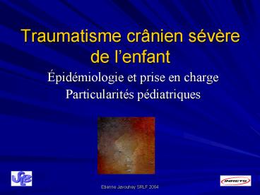 Traumatisme crnien svre de lenfant