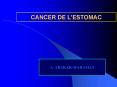 CANCER DE LESTOMAC PowerPoint PPT Presentation