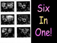 Six in One