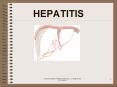 HEPATITIS PowerPoint PPT Presentation