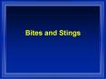 Bites and Stings PowerPoint PPT Presentation