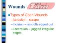 Wounds PowerPoint PPT Presentation