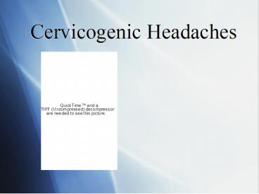 Cervicogenic Headaches