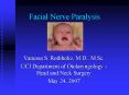 Facial Nerve Paralysis PowerPoint PPT Presentation