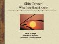 Skin Cancer: PowerPoint PPT Presentation
