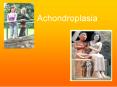 Achondroplasia PowerPoint PPT Presentation