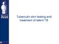 Tuberculin skin testing and treatment of latent TB PowerPoint PPT Presentation