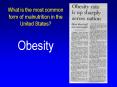 What is the most common form of malnutrition in the United States PowerPoint PPT Presentation