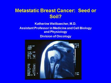 Metastatic Breast Cancer: Seed or Soil