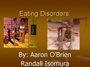 Eating Disorders: