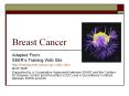 Breast Cancer PowerPoint PPT Presentation