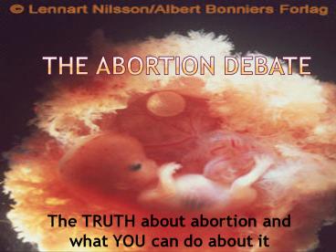 The Abortion Debate