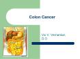 Colon Cancer PowerPoint PPT Presentation