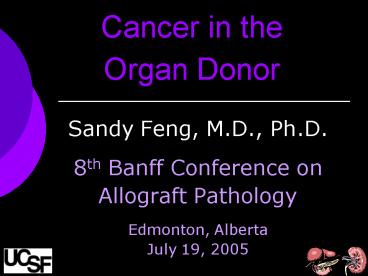 Cancer in the Organ Donor