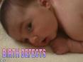 BIRTH DEFECTS PowerPoint PPT Presentation