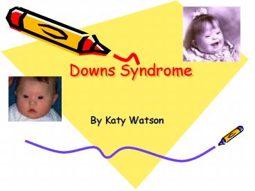 Downs Syndrome