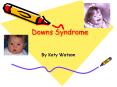 Downs Syndrome PowerPoint PPT Presentation