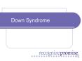 Down Syndrome PowerPoint PPT Presentation