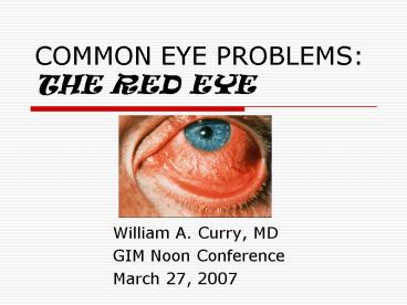 COMMON EYE PROBLEMS: THE RED EYE