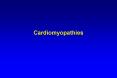 Cardiomyopathies PowerPoint PPT Presentation