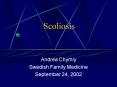 Scoliosis PowerPoint PPT Presentation