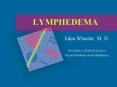 LYMPHEDEMA PowerPoint PPT Presentation