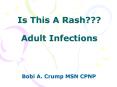 Is This A Rash Adult Infections PowerPoint PPT Presentation