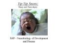 Yip Yip Snore: Sleep and Narcolepsy PowerPoint PPT Presentation