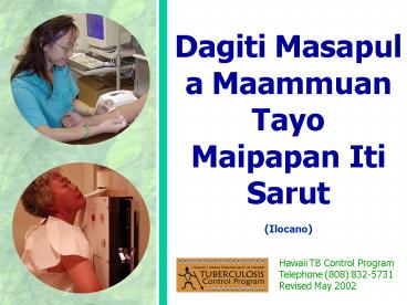 Dagiti Masapul a Maammuan Tayo Maipapan Iti Sarut