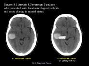 8.1. Non-contrast CT Brain