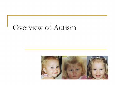 Overview of Autism