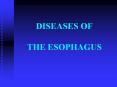 DISEASES OF  THE ESOPHAGUS PowerPoint PPT Presentation