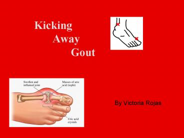 Kicking Away Gout