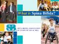 SPINA BIFIDA ASSOCIATION OF NAME OF LOCAL SBA PowerPoint PPT Presentation