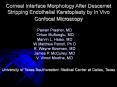 Corneal Interface Morphology After Descemet Stripping Endothelial Keratoplasty by In Vivo Confocal Microscopy PowerPoint PPT Presentation