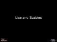 Lice and Scabies PowerPoint PPT Presentation