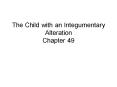 The Child with an Integumentary Alteration Chapter 49 PowerPoint PPT Presentation