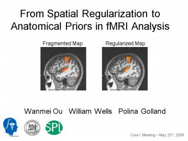 From Spatial Regularization to Anatomical Priors in fMRI Analysis